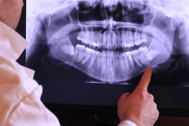Best 24-Hour Emergency Dental Care in Bourg, LA